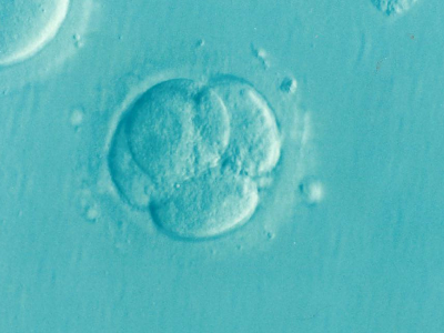 Photo of IVF