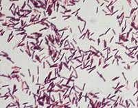 Anthrax Bacteria Gram Stain