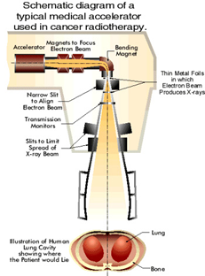 Schematic diagram of a typical medical accelerator used in cancer radiotherapy